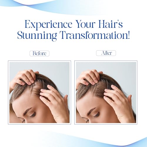 Image of VCare Hair Growth Vitalizer for Men & Women, Oil-Free Hair Serum, Reduces Hair Fall, Boosts Hair Growth, Nourishes Scalp, Non-Sticky Formula, 2 x 100ml, Hair Care Essential for All Hair Types