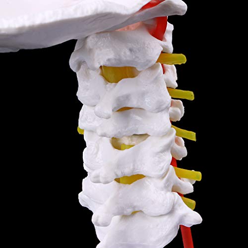 Expliquer la hernie cervicale avec le modèle colonne et nerfs rachidiens - 3