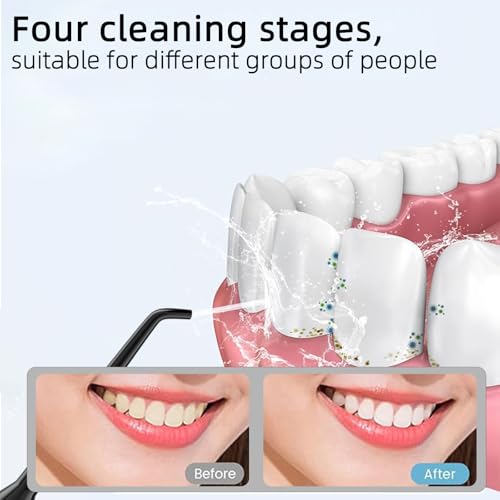 Zahnseide für Wasser: Tragbare, schnurlose Munddusche, 320 ml, wiederaufladbarer Reisebewässerungsreiniger mit 5 Zahnseidespitzen, IPX7 wasserdichte elektrische Zahnseidemaschine für die Zahnreinigung – Bild 8