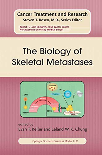 The Biology of Skeletal Metastases (Cancer Treatment and Research Book 118)