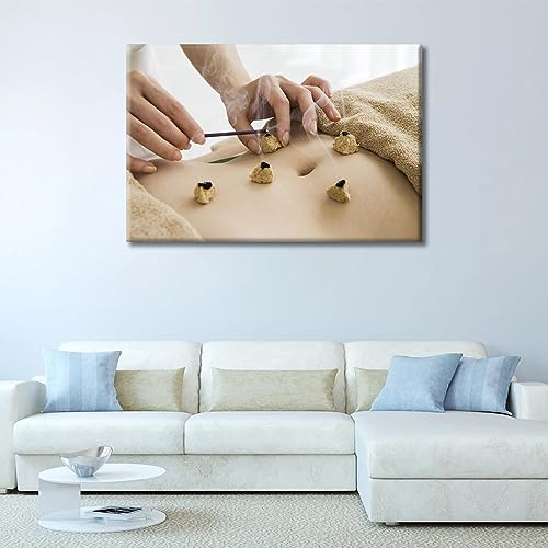 Image of TUMOVO 1 Panels Moxibustion Canvas Wall Art Moxa Moxibustion Posters Paintings for Wall Decorations Nosocomium Artwork Canvas Photo Stretched and Framed Ready to Hang (24 inch Wx36 H)