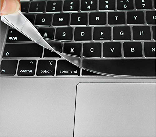 Funda MacBook Pro 16 A2141 antideslizante que soluciona problemas de calor 7