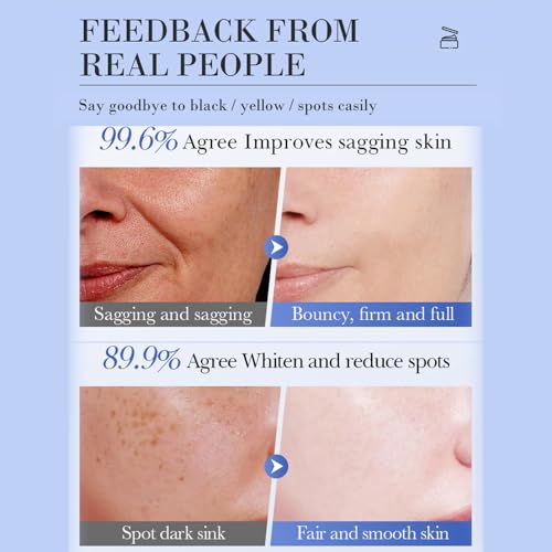Grospe Salicylic Acid Face Cream - Acne & Pore Refining for Face Oil-Free Facial Moisturizer with BHA, Face Cream for Oily & Combination Skin 1.7oz