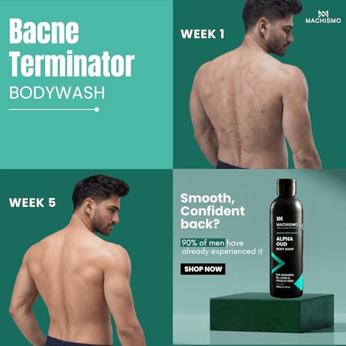 Image of Machismo's Bacne Terminator Body Wash for Men | Back Acne Treatment | 12-Hour Moisturizing | All Skin Types | Clear Skin | Deep Cleansing