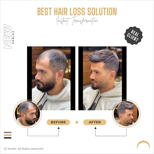 Image of Artello PREMIUM MONO Smart Hair Patch for Men, Smooth Hair Wig in 100% Natural Human Hair, Easy Fit with Tape, Glue or Clips, 3D Premium Base (Colour: Natural Black) (7x5)