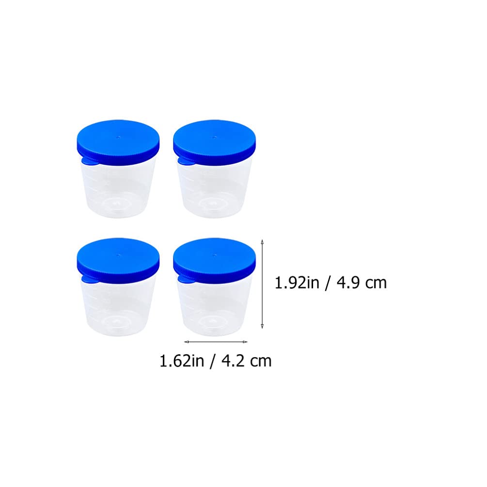 Scicalife 100 Unidades de Vasos de Muestra para Orina Vasos de Plástico para Recolección de Orina Vasos de Muestra con Tapas para Prueba de Embarazo de Laboratorio 40ML