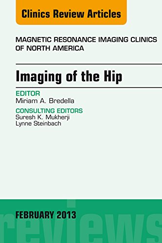 Imaging of the Hip, An Issue of Magnetic Resonance Imaging Clinics (The Clinics: Radiology)      Kindle Edition