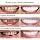 Commuter Travel Smile Enhancement, 2 Pairs Pocket Size Design, Unisex Flexible Reusable Adjustable On-the-Go Set Tooth Whitener(Bright White2) - 2