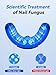 Nail Fungus Cleaning Light, Toenail Fungus for Multiple Fingernails & Toenails, Portable Nail Fungus Solution for Onychomycosis, Useful for Discolored and Thickened Nails