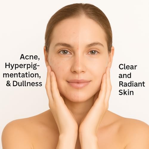 Image of Vitamin C Serum with Niacinamide - Topical Vitamin C Cream for Dark Spots, Brightening & Even Skin Tone | Glutathione & Kojic Acid | 30ml