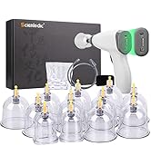 12-teiliges elektrisches Schröpf-Set, Cellulite-Schröpftherapie-Massagegerät, wiederaufladbares V...