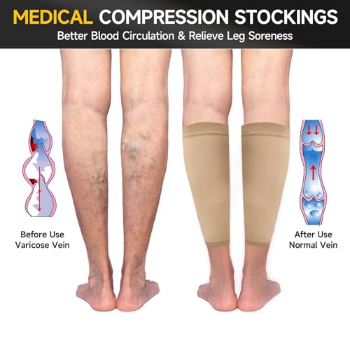Image of 15-20 mmHg Compression Socks for Women & Men, Pregnancy Compression Socks Medical Footless Graduated Compression Stockings for Varicose Veins, Edema, DVT, M