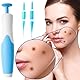 Stielwarzen selbst entfernen,Auto Tool Kit Skin Tag Remover Gerät Schnell Wirkendes Gerät Zum Entfernen Für Kleine Bis Große Hautmarken Und Warzen Für Alle Körperteile