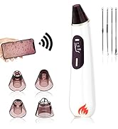 Blackhead Remover Vacuum Bonus 4PCS Stainless Black Head Remove Tools, Black Head Remover Suction...