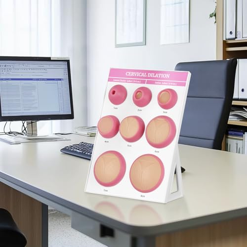 Image of Cervical Dilation Simulator with 1-8cm, Gynecological Examination Model, Chart on Display Board for Midwife and Doula Training, Medical Education, and Birth Learning