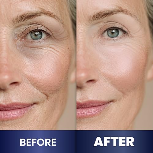 Night Cream for Women Anti Aging - Night Moisturizer for Face with Retinol, Peptides, Niacinamide - Anti-Wrinkle, Firming & Hydrating Skin Care - Fragrance-Free, Non Greasy Overnight Face Cream - Image 5
