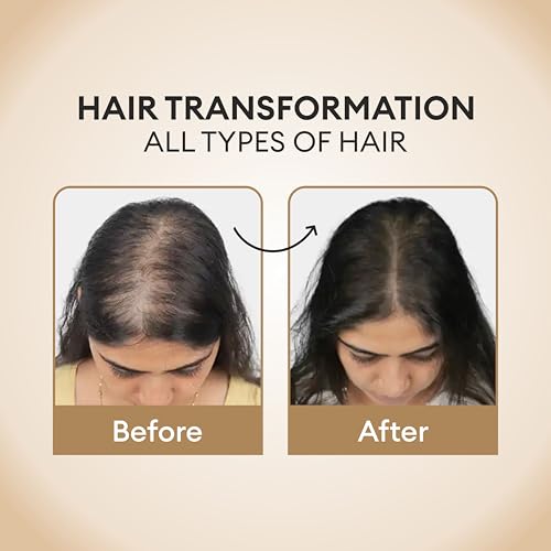 CO LUXURY Foligroin Hair Growth Serum 100 ml - Image 6