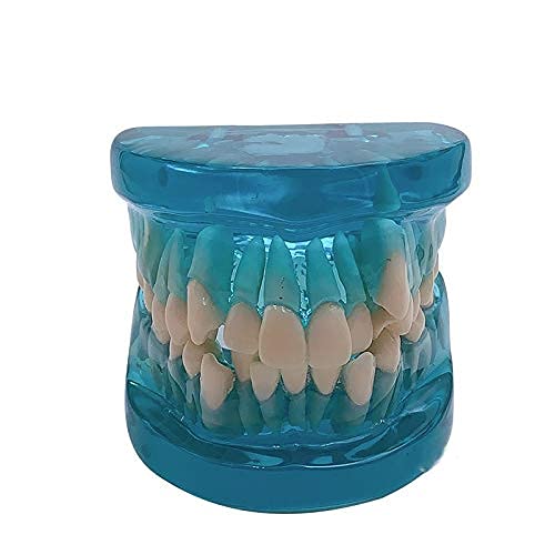 Modèle d'orthodontie Type de Dents pour Adultes, modèle de Dents dentaires Standard, modèle d'étude pour Soins des Dents. Modèle Standard pour l'enseignement