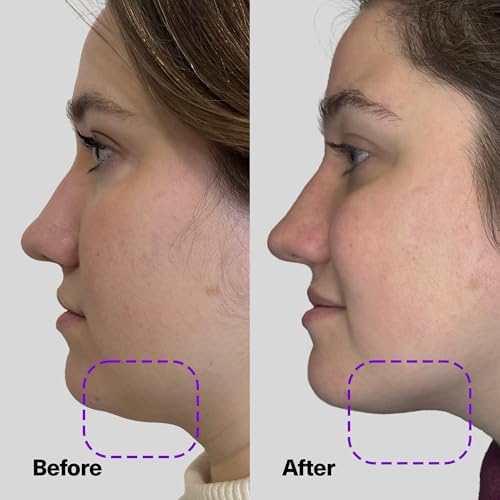 SickScience ShapeShift Advanced Jaw & Neck Firming Serum - Double Chin Reducer, Face Tightening Treatment with Exosome Technology to Lift Sagging Skin & Wrinkles in both Women & Men, 1.7oz - Image 4
