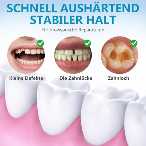 Zahnzement & Zahnreparaturset – Zahnkleber für Provisorische Füllungen, Kronen & abgebrochene Zähne – Extra Starkes Dental Kit (20g + 10ml)
