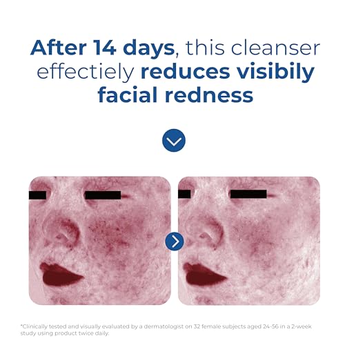 EltaMD Skin Recovery Amino Acid Foaming Cleanser 5oz — view 9