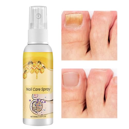 Aceite para Uñas - 100ml Spray de Aceite Orgánico para Crecimiento de Uñas | Fortalece y Cutículas Solución de Belleza Líquida Renovadora para Viaje Salón Hogar Hombre