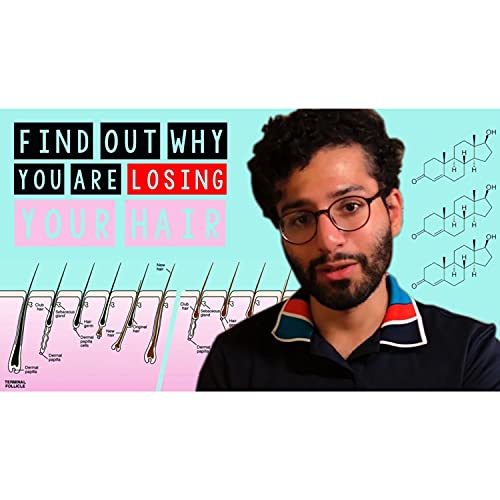 Hair Loss: Androgenic Alopecia & Minoxidil Treatment