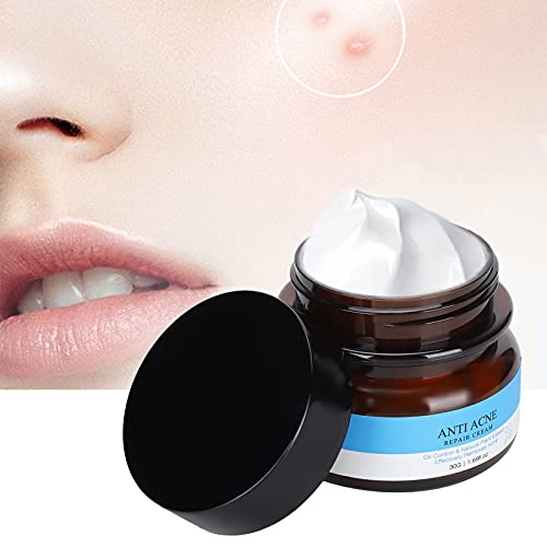 Acne Removal Cream, 30G Acne Spot Treatment Cream Acne Treatment Cream Scar Cream Cream Facial Acne Remover For Face Moisturizers For Spots Blackheads