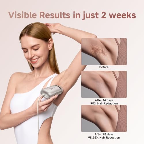 Image of Dreame Nova IPL Hair Removal with Dual-Lamp 27J Output, Sapphire ICE Cooling, 3.9cm Window, 0.2s Flash, Adaptizone AI Detection, Photon Skincare, Up to 96% Reduction Full-Body for Women and Men
