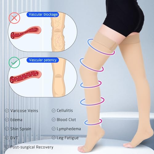 Image of 15-20 mmHg Compression Stockings for Women & Men, Thigh High Compression Socks Medical Graduated Compression Support for Edema, Varicose Veins