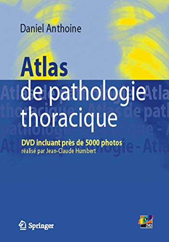 Atlas de pathologie thoracique (French Edition) Atlas de pathologie thoracique (French Edition)