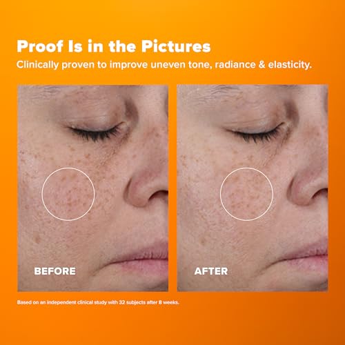 Paula'S Choice Paula’S Choice 25% Vitamin C Serum With Glutathione & Antioxidants thumb #3