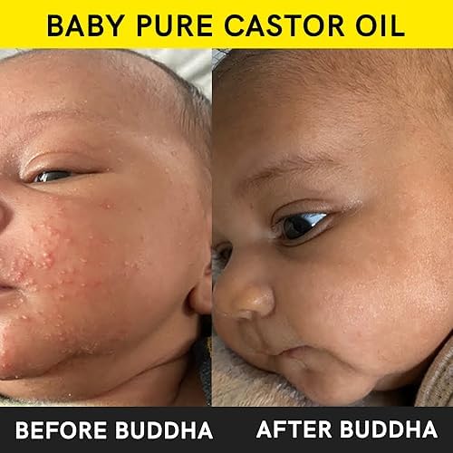 Buddha Natural Baby Castor Oil Cold Pressed Extra Virgin - Nourishing, Moisturizing, Soothing For Delicate Skin And Hair Growth - Chemical-Free (150 Ml (Pack Of 1))