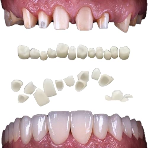 Image of Temporary Tooth Veneer Crowns Kit - 100PCS /Box (50 Anterior + 50 Posterior) - DIY Fake Teeth Cap for Missing Teeth & Natural-Looking Smile Restoration for Holiday Cosplay