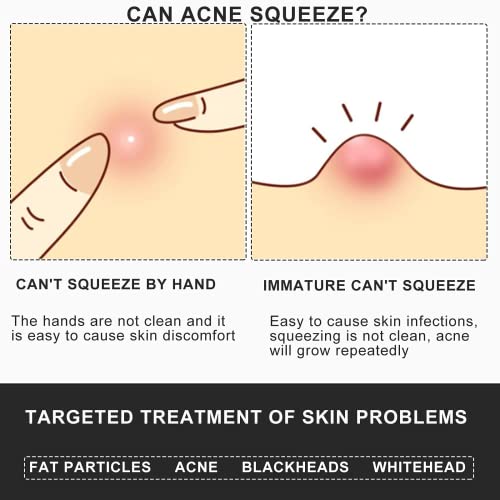 Professional Facial Milia Removal And Whitehead Extractor & Lancet - Double Ended Circle Loop & Sharp Needle Pimple Tool - 2-In-1 Blackhead & Blemish Remover - Zit And Pimple Acne (4.6In-Sliver) #TOP4