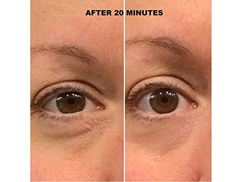 Miniatura 9 de Máscara de ojos de gel para dormir. Alivia el estrés y reduce la hinchazón