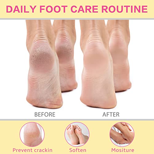 2Pcs Springsugar Hydrating Foot Cream, Quick Absorbed & Soften Dry Cracked Heel,Calluses,Corns Feet Balm - Shea Butter,Beeswax,Vitamin E,Betaine,Chlorella Vulgaris Extract Skin Moisturizer, 2 X 3.5 Oz #TOP2