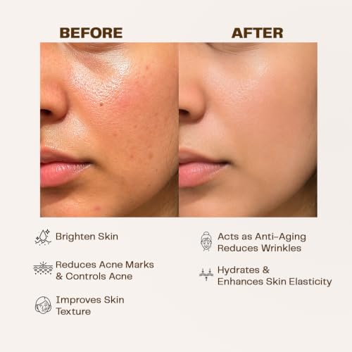 Image of Natural Moringa Face Oil for Glowing Skin | Lightweight & Non-Greasy | With Tea Tree, Orange & Moringa | Acts Like a Serum for Clear, Bright Skin | 30ml | For Men & Women