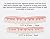 Imako Cosmetic Teeth 1 Pack. (Large, Natural) Uppers Only- Arrives Flat. Fit at Home Do it Yourself Smile Makeover!