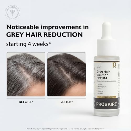 Image of Proskire Grey Hair Solution Serum | Arcolys, Melanogray, Biotin, Black Tea & Bhringraj | Helps to Reduce Premature Greying & White Hair Problem | For Men & Women | 30 ml