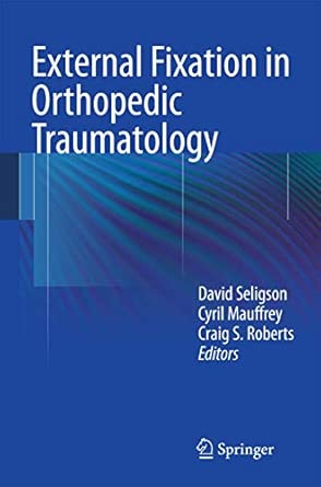 External Fixation in Orthopedic Traumatology 2012th Edition-Wow! eBook
