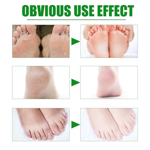 3 Pairs Foot Peel Mask – Aloe Vera Exfoliating Foot Peel Mask - Foot Mask Peel for Dry, Cracked Heels & Calluses – Moisturising Foot Peel Socks - Peeling Foot Mask for Hydrating & Softening - Image 5