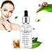 Gesichtsserum, Serum mit Schneckenschleim und Hyaluron Hochdosiert, Hyaluron Serum, Hautberuhigendes, Anti-Aging, Feuchtigkeitspflege für Ein Strahlendes Aussehen,Vegane Naturkosmetik, 30ML Vegane günstig Kaufen-Gesichtsserum, Serum mit Schneckenschleim und Hyaluron Hochdosiert, Hyaluron Serum, Hautberuhigendes, Anti-Aging, Feuchtigkeitspflege für Ein Strahlendes Aussehen,Vegane Naturkosmetik, 30ML