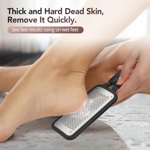 Kolavia 2-Pack Stainless Steel Foot File