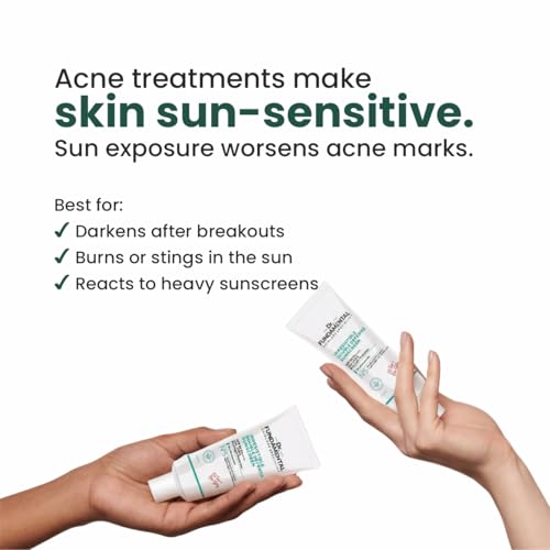 Image of Irresistible Double Defence Sunscreen | Sunscreen for Oily Skin SPF 50 PA++++ | No White Cast | Lightweight Non-Greasy Formula | Broad Spectrum & Blue Light Protection | Clinically Tested - (In-Vivo) - 50 ml