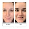 Replenix BP Acne Face Wash, 6.7 Fl Oz, Non-Oily Benzoyl Peroxide Facial Cleanser with Medical-Grade Ingredients for Acne-Prone Skin, Gently Unclogs & Refines Pores, Non-Drying & Non-Irritating