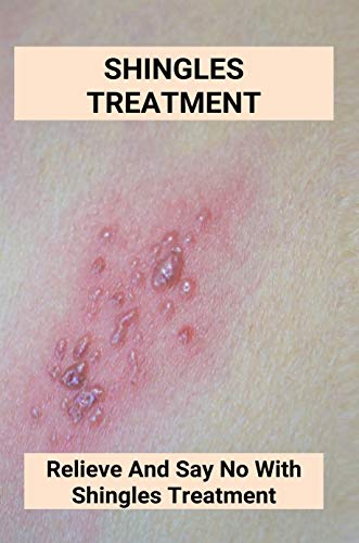 Shingles Treatment: Relieve And Say No With Shingles Treatment