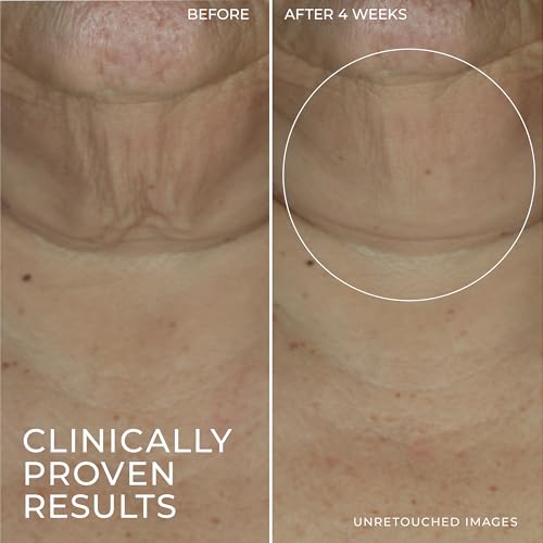 Roc Derm Correxion Advanced Retinol Firming Serum Stick With Antioxidants To Visibly Tighten And Firm Wrinkles And Laugh Lines thumb #5