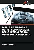 Displasia Fibrosa E Oltre: Comprensione Delle Lesioni Fibro-Ossee Della Mascella 620872774X Book Cover