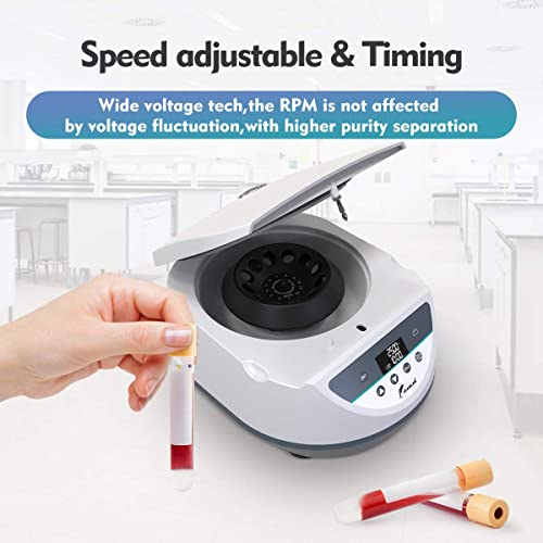 Centrifugeuse PRP avec affichage numérique à haute précision de 500 à 5000 tr/min - 6